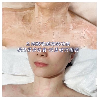 生物酶疗（刷酶）